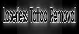 Laserless Tattoo Removal Coupon Codes