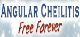 Angular Cheilitis Free Forever Coupon Codes